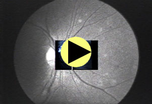Eyesight 1